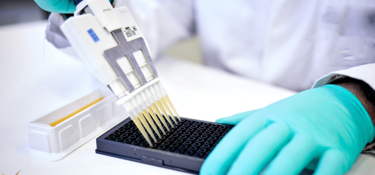 The Lab Comes Home: How The Leo Systems High-Throughput Protein Analysis Redefines Personal Health In 2026